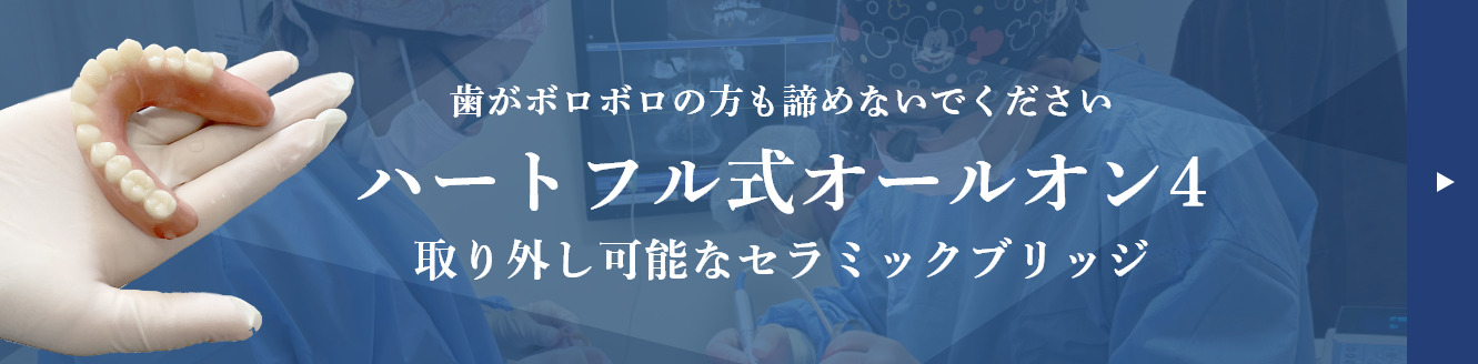 ハートフル式オールオン4　取り外し可能なセラミックブリッジ