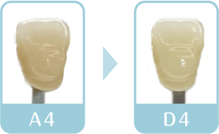 ホワイトニング1回目終了後　歯の色
