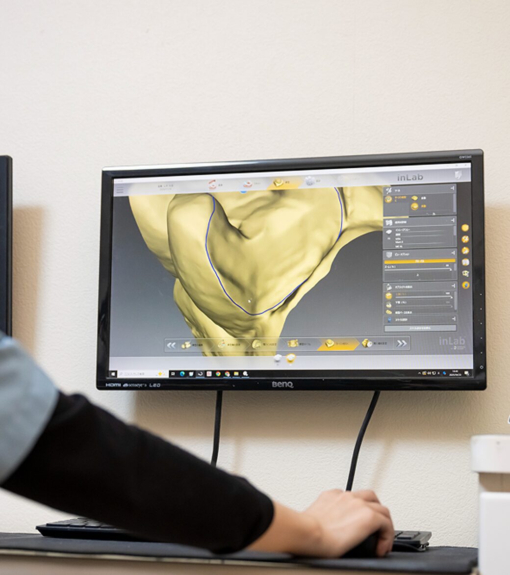 ジルコニアミリングを臨床レベルで安定化